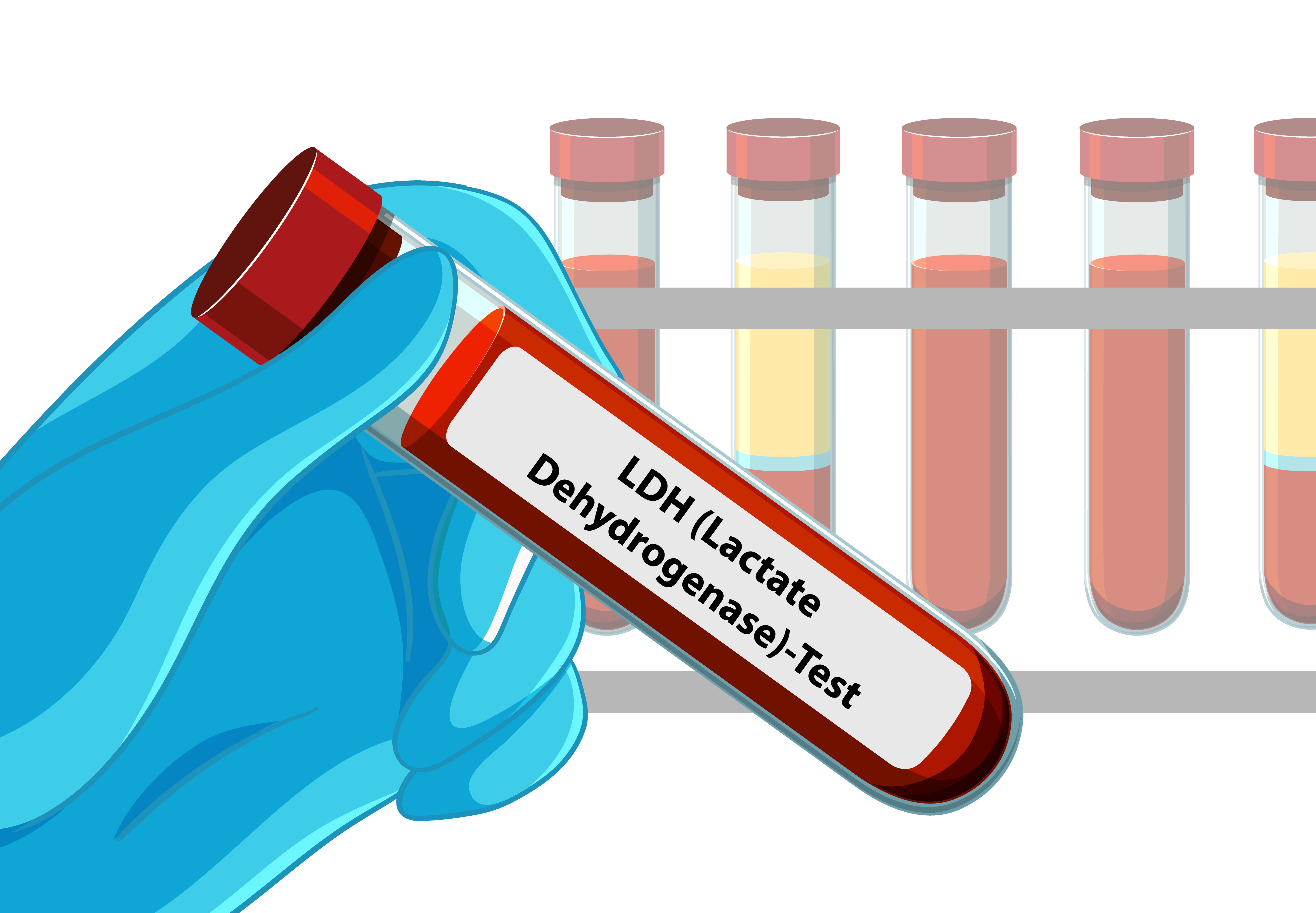 Home Blood Sample Collection in Gurgaon — How It Works and Why It's Safe
