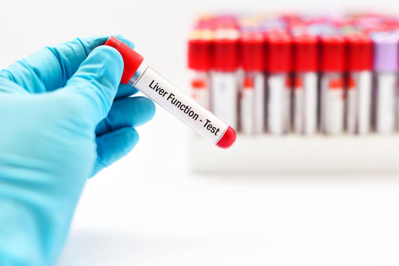 Liver Function Tests: When and Why You Need One
