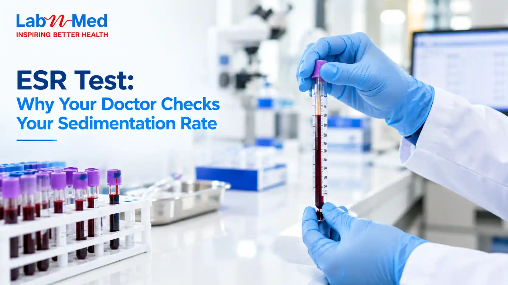 ESR Test: Why Your Doctor Checks Your Sedimentation Rate
